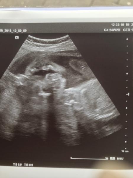 Bild zu Yoga-Baby (heutige VU) - Forum für April - Mamis