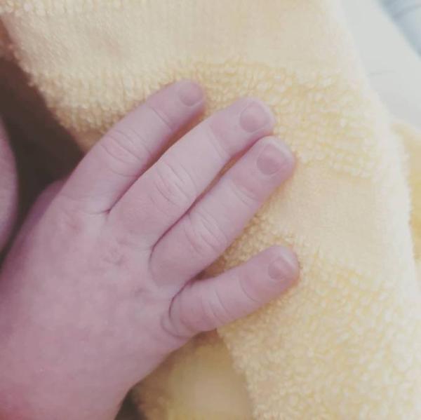 Bild zu Unser Sorgenkind ist da :) - Forum für April - Mamis