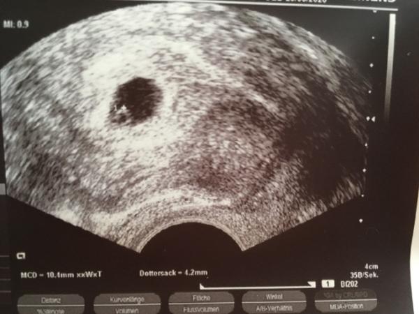 Bild zu Ergebnis vom 1. FA-Termin - Forum für April - Mamis