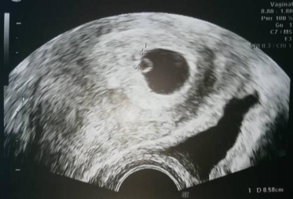 Bild zu Herzchen schlägt❤️ - Forum für April - Mamis