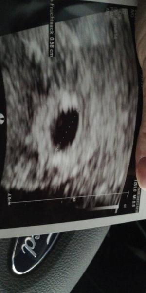Bild zu Bin dabei - Forum für April - Mamis