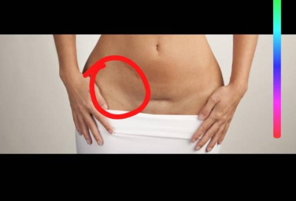 Bild zu Angst/Eileiterschwangerschaft? - Forum für April - Mamis