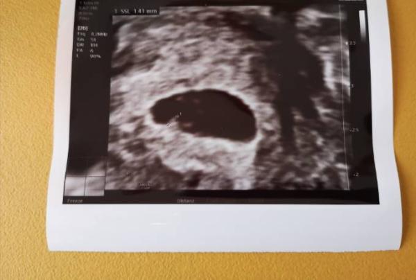 Bild zu Herzschlag ❤️ - Forum für April - Mamis