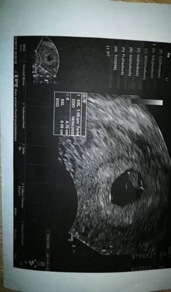 Bild zu Heute endlich den ersten Termin - Forum für April - Mamis