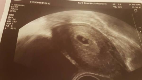 Bild zu grade vom Arzt zurück - Forum für April - Mamis