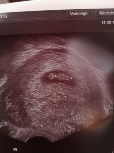 Bild zu Zurück vom FA - Forum für April - Mamis