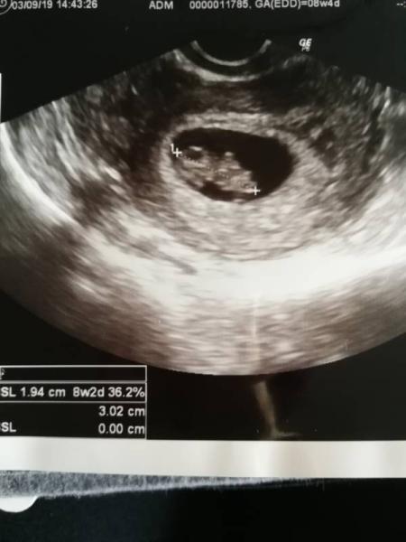 Bild zu Gestern beim Frauenarzt - Forum für April - Mamis