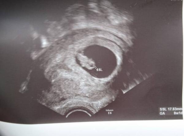 Bild zu Heutiger Termin - Forum für April - Mamis