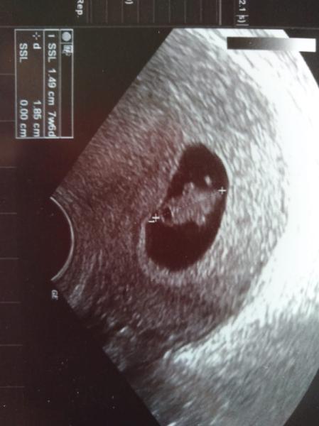 Bild zu Auch zurück vom FA - Forum für April - Mamis