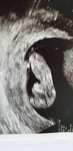 Bild zu Zurück vom FA - Darf ich bei euch bleiben? - Forum für April - Mamis