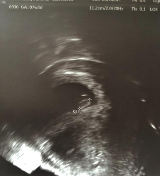 Bild zu Zurück vom Arzt - Forum für April - Mamis