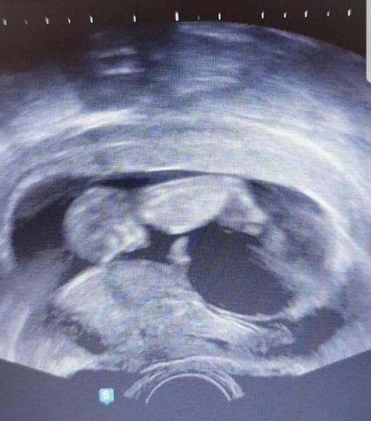 Bild zu 12. Ssw. - Forum für April - Mamis