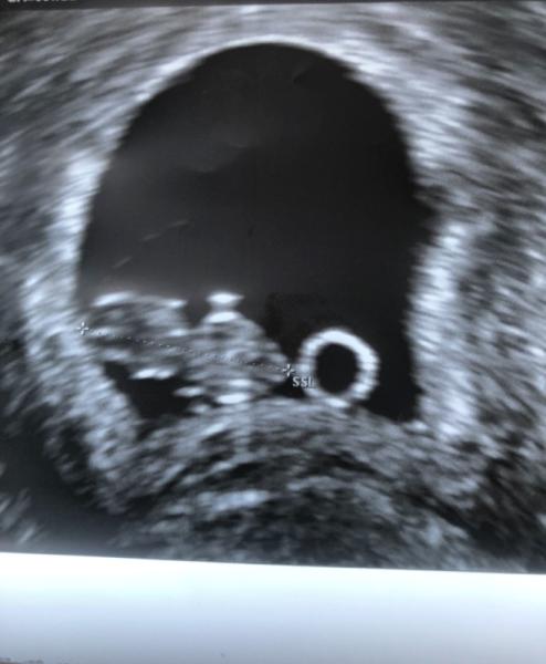 Bild zu Gestern Termin FA - Forum für April - Mamis