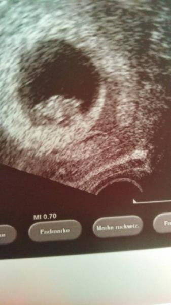 Bild zu Ich setze mich mal vorsichtig! - Forum für April - Mamis