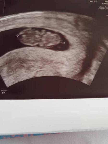 Bild zu So zurück  vom Gyn - Forum für April - Mamis