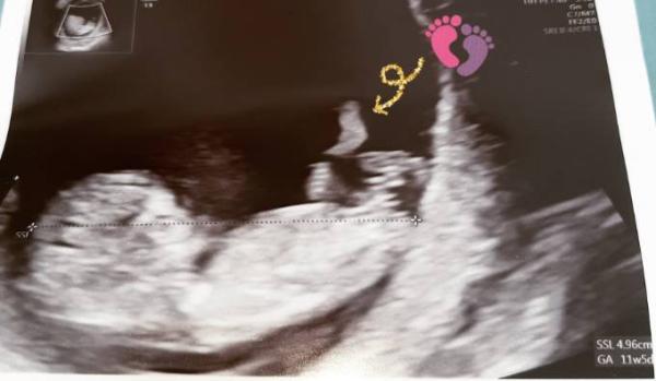 Bild zu Ich bin verliebt < 3 FA termin. - Forum für April - Mamis