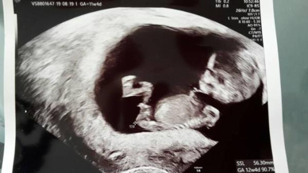 Bild zu Heute FA - Forum für April - Mamis