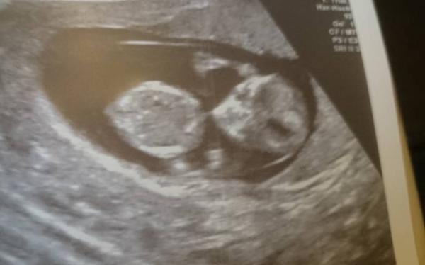 Bild zu Zurück vom FA 11+3 - Forum für April - Mamis