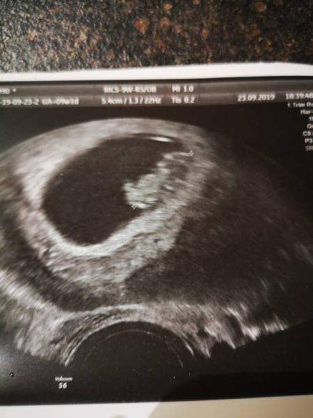 Bild zu Heute FA Termin bei 9+1 - Forum für April - Mamis