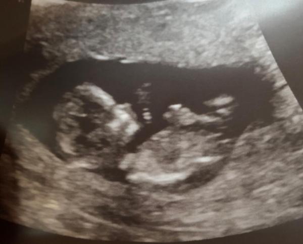 Bild zu Wow... ich bin sprachlos... - Forum für April - Mamis