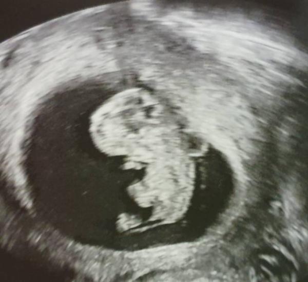 Bild zu Unbeschreiblich... - Forum für April - Mamis