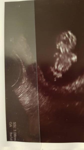 Bild zu Ich bin wieder da mit guten Neuigkeiten  - Forum für April - Mamis