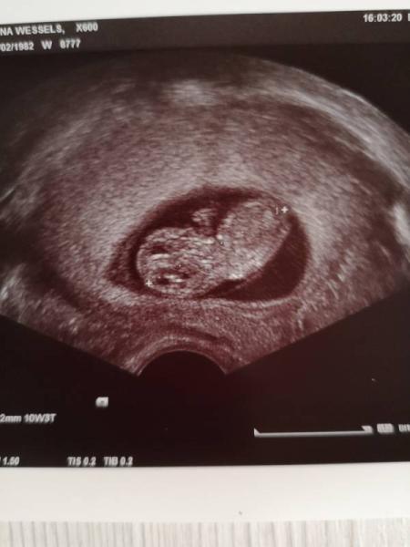 Bild zu Heute FA Termin gehabt.... - Forum für April - Mamis