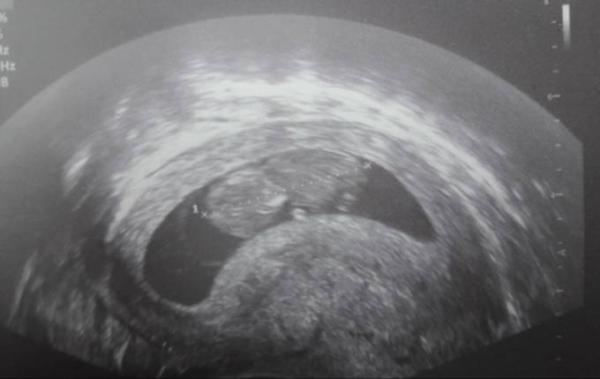 Bild zu Darf ich auch noch mitfahren? - Forum für April - Mamis