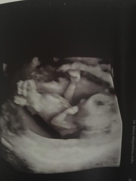 Bild zu Combine Test - Forum für April - Mamis