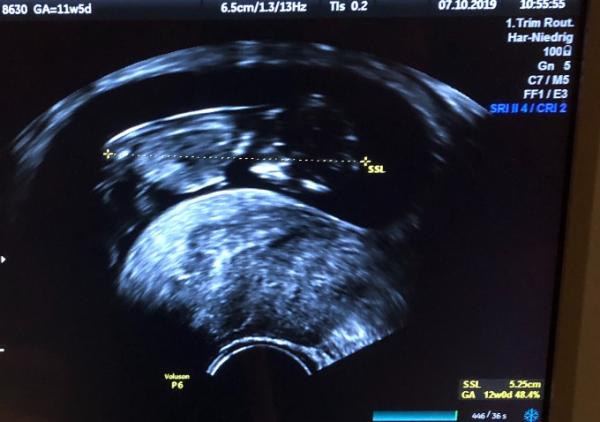 Bild zu Heute FA-Termin gehabt - Forum für April - Mamis