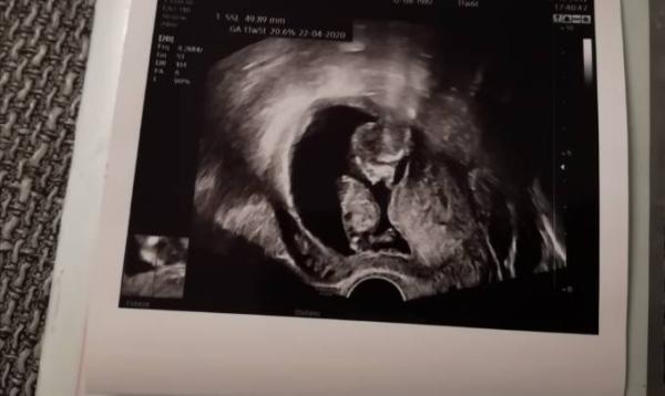 Bild zu Fa Termin - Forum für April - Mamis