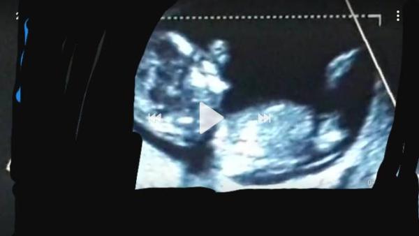 Bild zu Mag auch wissen wer da in mir ist :-) - Forum für April - Mamis