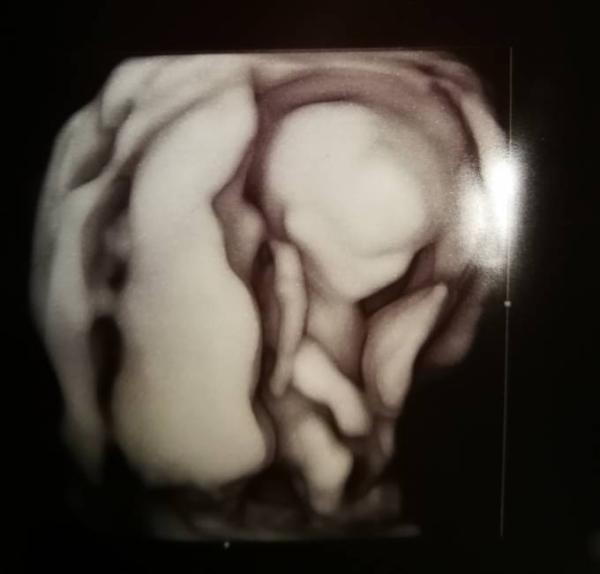 Bild zu ETS - Forum für April - Mamis