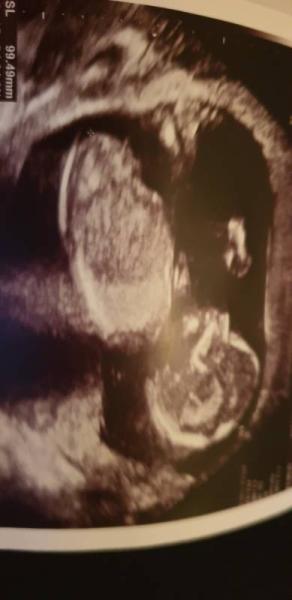 Bild zu Zurück vom Baby-TV mit Outing - Forum für April - Mamis