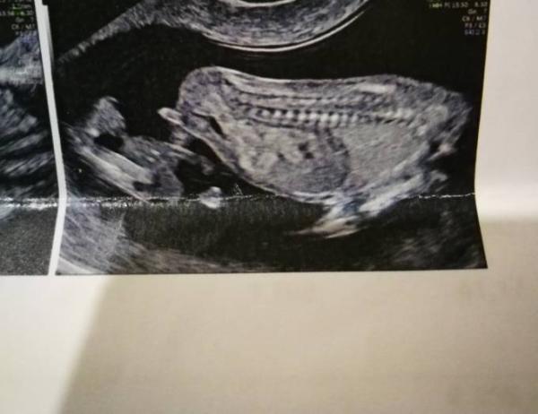 Bild zu Nub??? - Forum für April - Mamis