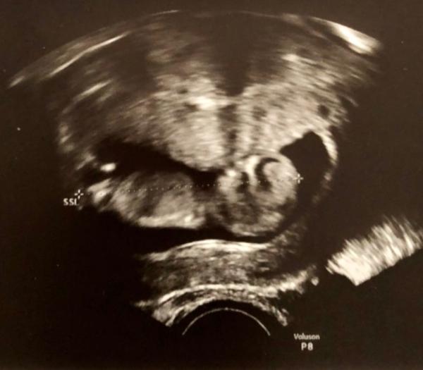 Bild zu Bericht vom Frauenarzt - Forum für April - Mamis