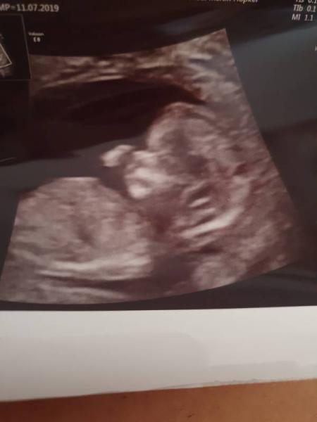 Bild zu Zurück vom Termin  - Forum für April - Mamis