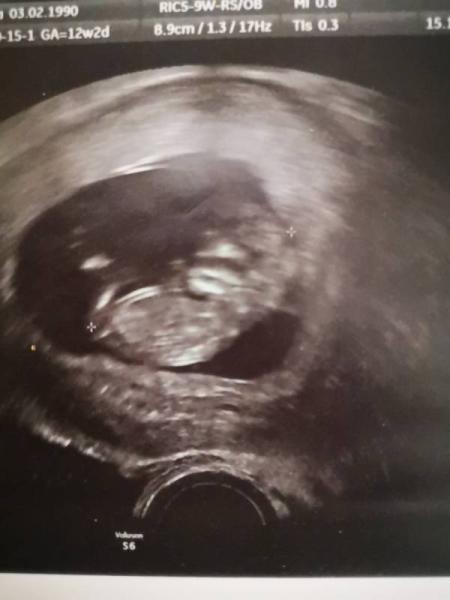 Bild zu Zurück vom FA - Forum für April - Mamis