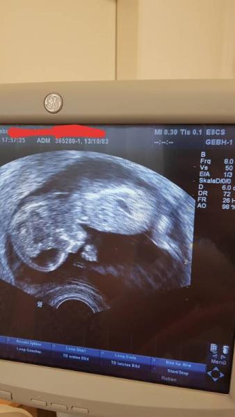 Bild zu So süß  - Forum für April - Mamis