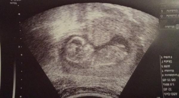 Bild zu Alle sagen immer... - Forum für April - Mamis