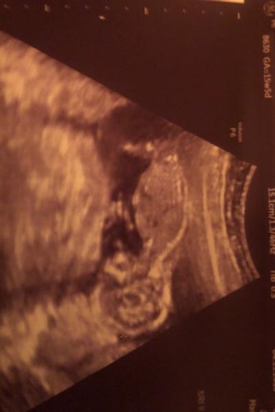 Bild zu Gestern FA - Forum für April - Mamis