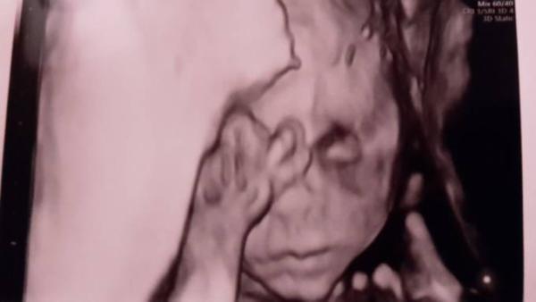 Bild zu Heute FA-Termin - Forum für April - Mamis