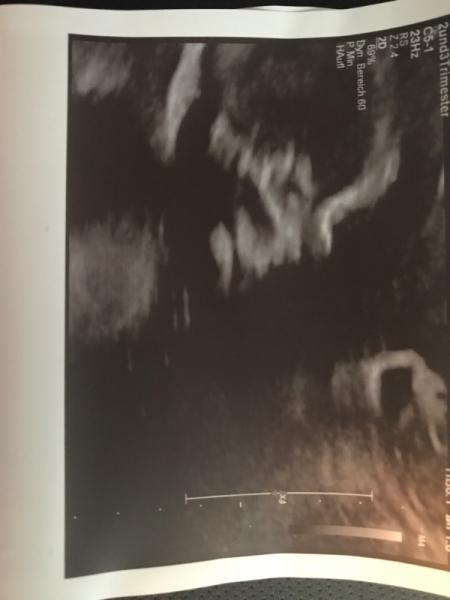 Bild zu Halbzeit! - Forum für April - Mamis