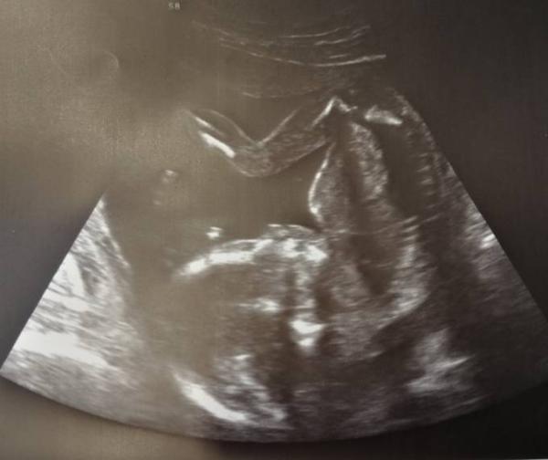 Bild zu Termin :) - Forum für April - Mamis