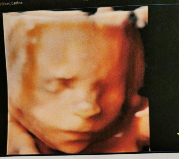 Bild zu Zurück von der feindiagnostik - Forum für April - Mamis