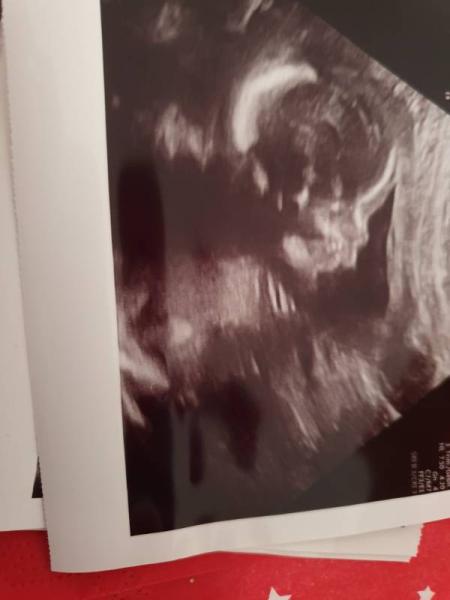 Bild zu Zurück vom 2 ten Screening  - Forum für April - Mamis