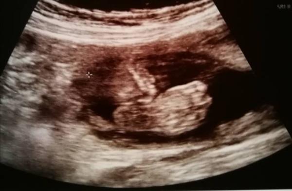 Bild zu Outing - Forum für April - Mamis