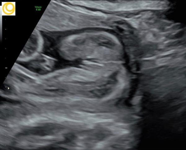 Bild zu Mädchen outing Bilder - Forum für April - Mamis