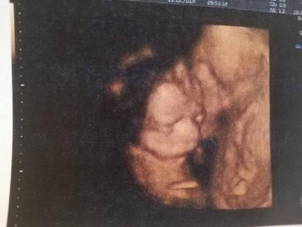 Bild zu Awwwwwww < 3 < 3 < 3 - Forum für April - Mamis