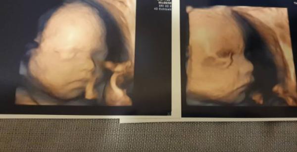 Bild zu Zurück vom 3D - Schockverliebt - Forum für April - Mamis